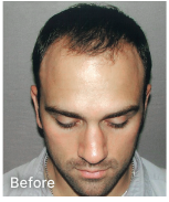 Jeff before Image - Man's head in detail